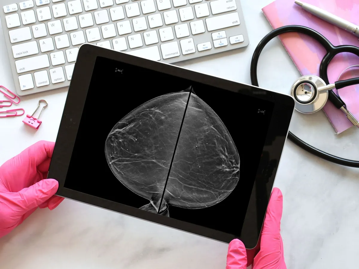 Eldivenli eller, tablette bir mamografi görüntüsünü tutuyor